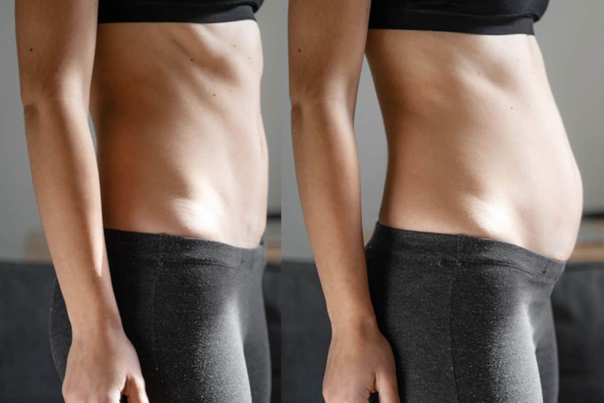 How long does diastasis recti take to improve Harwich?