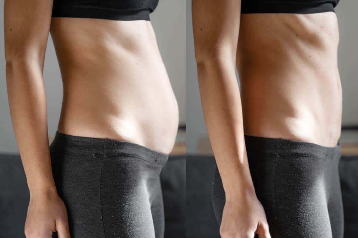 Post-Pregnancy: What Happens to Your Abdominal Muscles After Birth Harwich