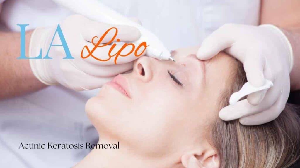 actinic keratosis removal Harwich