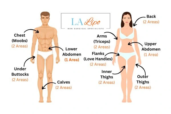 LA LIPO Cryolipolysis Areas Harwich
