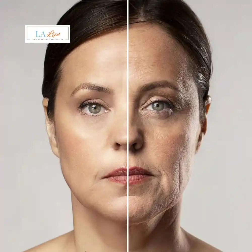 How Can You Tell If Non-Surgical Skin Tightening Is Right for You Harwich?